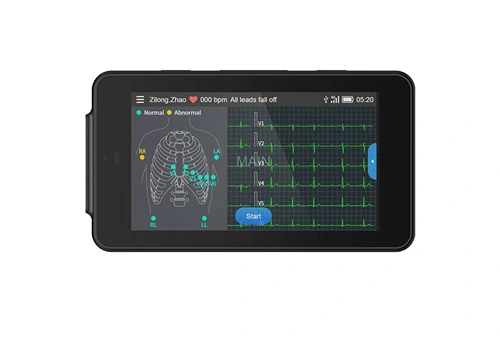 Lepu Medical PCECG-500 Monitora de ECG en reposo portátil de 12 derivaciones ECG de bolsillo